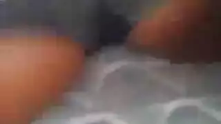 لاعبة جمباز قرع طبي